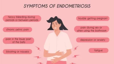 Is There a Connection Between Endometriosis and Digestive Distress?