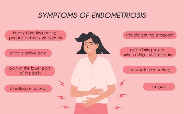 Is There a Connection Between Endometriosis and Digestive Distress?