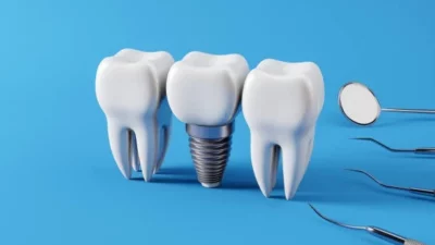When Tooth Implants Go Wrong