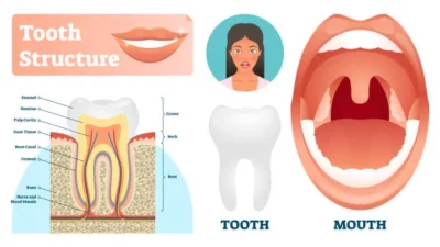 Charcot-Marie-Tooth Disease