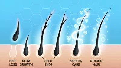 Curly Hair Types
