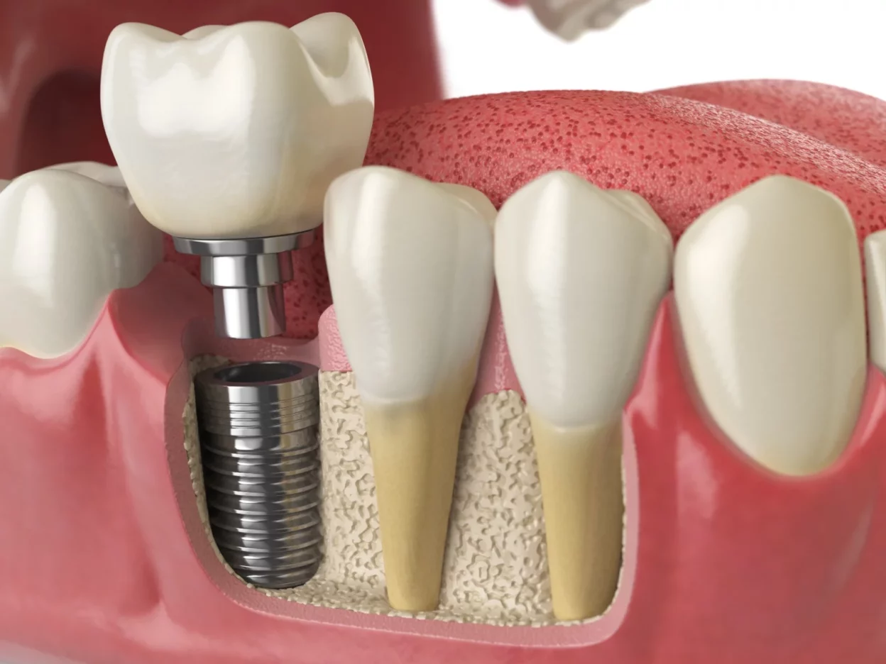 Advancing Your Dental Career