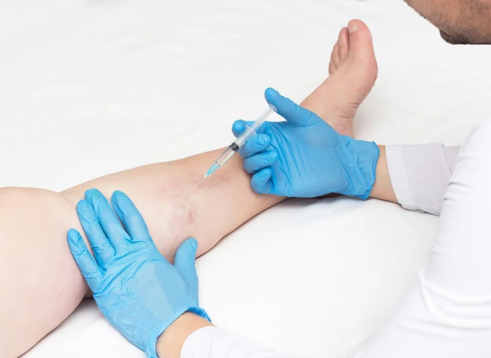 How ultrasound vein exams support minimally invasive treatments