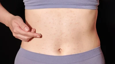 Going on with Your Skin